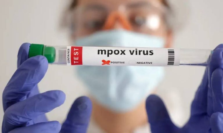 Amazonas registra 30 casos confirmados de Mpox em 2025