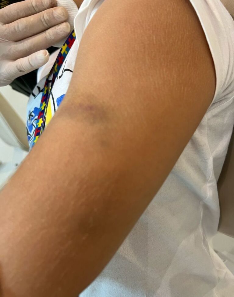 Vereador denuncia agressão a criança autista em escola de Manaus